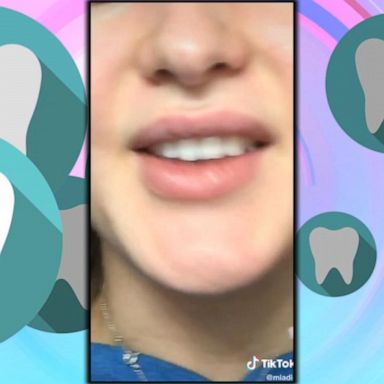 VIDEO: TikTok users turn to app for DIY dental care