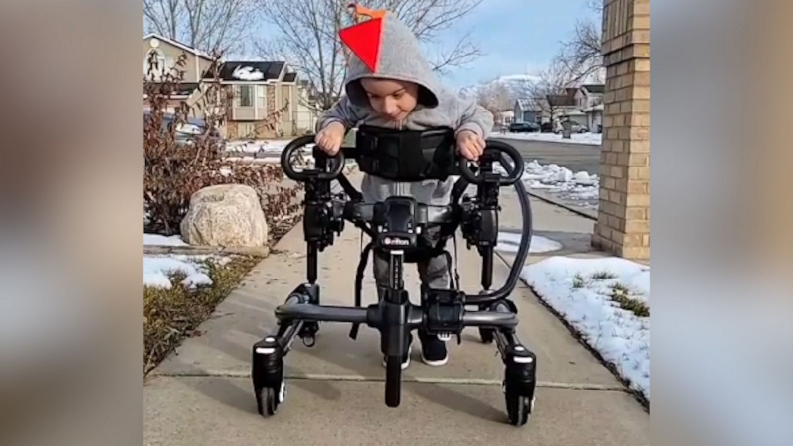 VIDEO: Toddler with Cerebral Palsy smiles as he takes his first steps