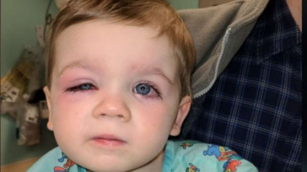 Mom's viral warning on tub toys after toddler's terrifying infection - Good  Morning America