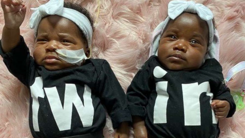 Twins reunite after being seperated for one's heart surgery.