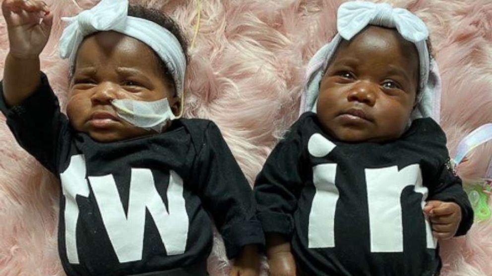 PHOTO: Twins reunite after being seperated for one's heart surgery.