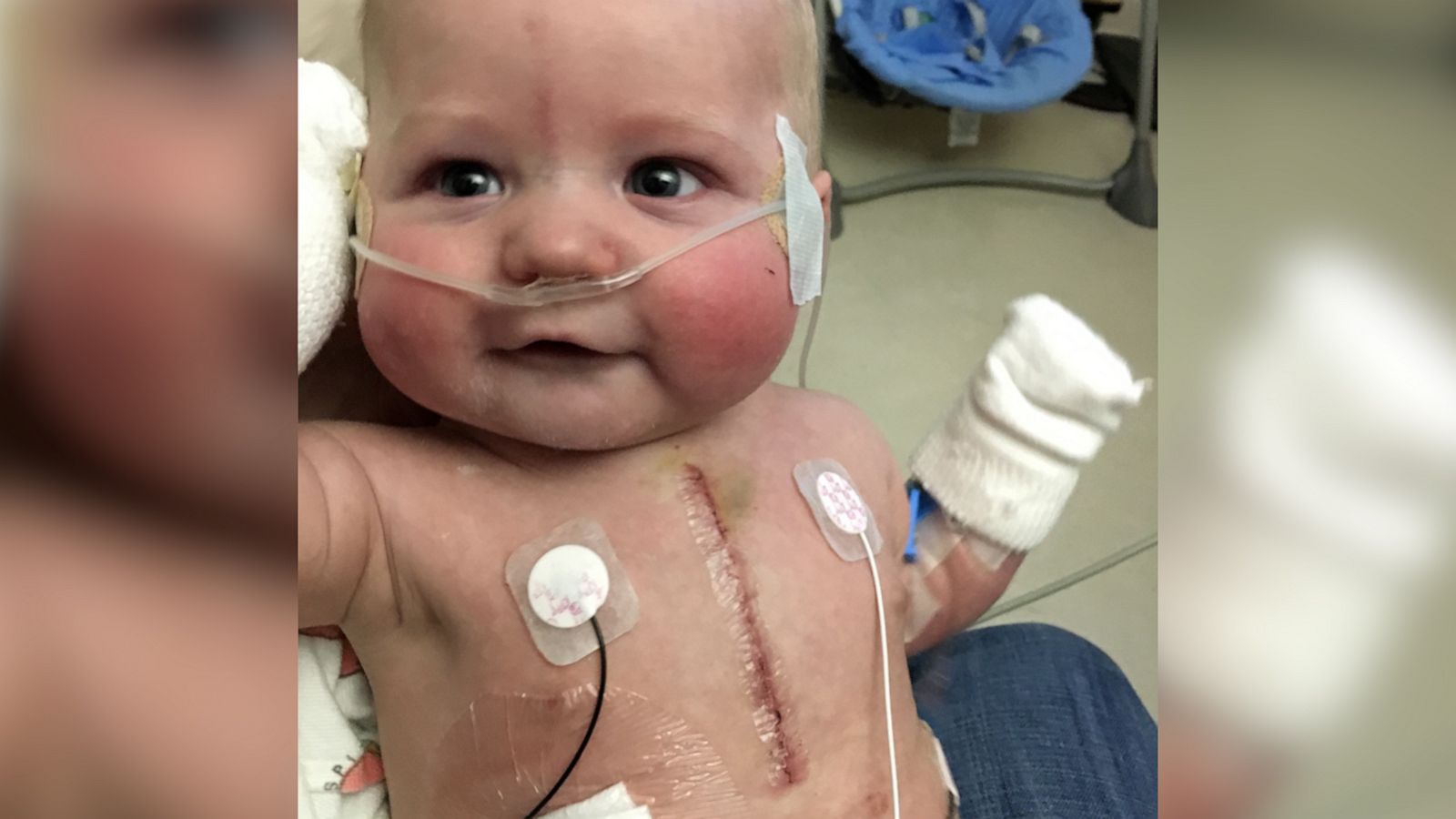 VIDEO: Doctors said baby with heart defect wouldn’t live past 30, but Mom’s not giving up