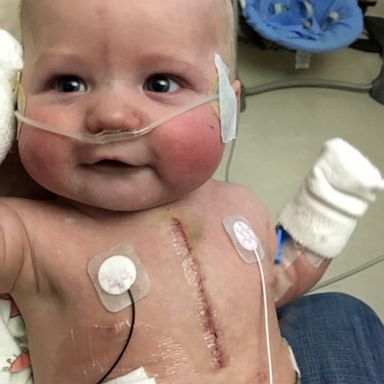 VIDEO: Doctors said baby with heart defect wouldn’t live past 30, but Mom’s not giving up 