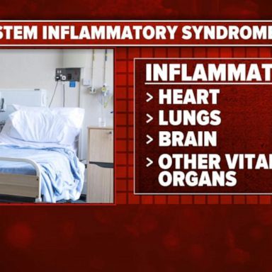 VIDEO: Cases of COVID-19-linked syndrome on the rise in kids