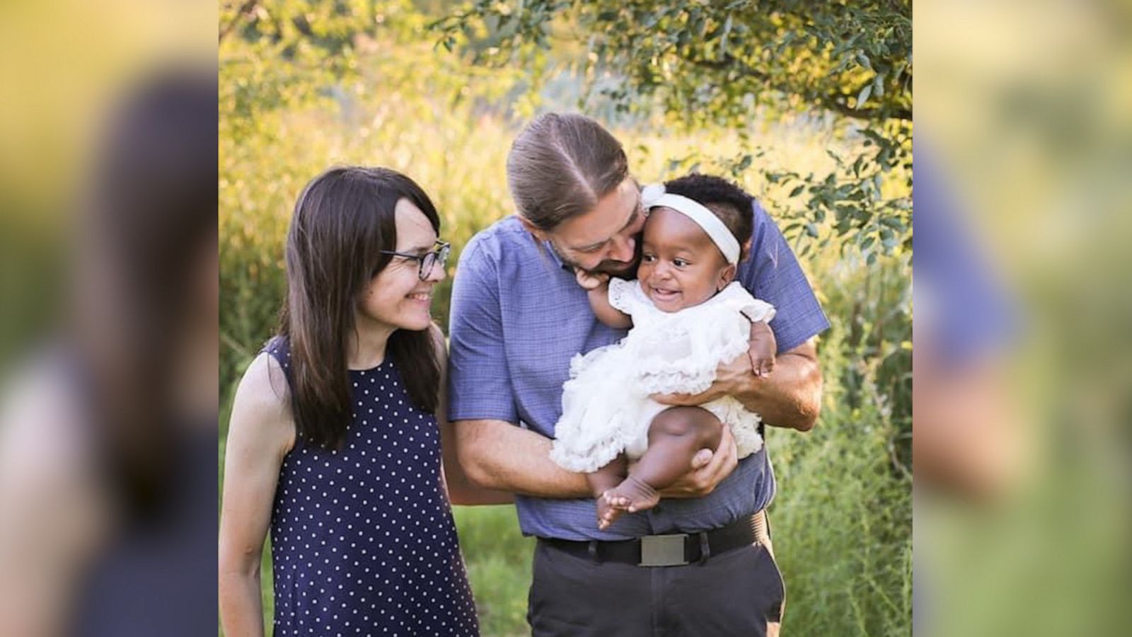 VIDEO: Father who lived with a physical difference bonds with daughter who has her own