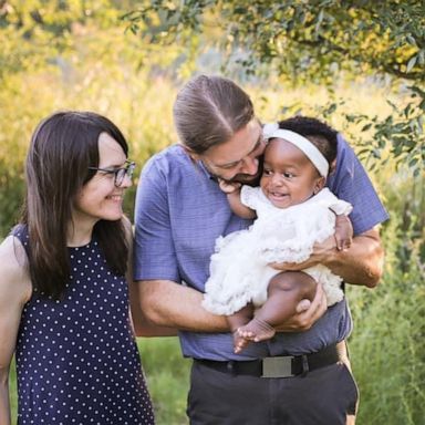 VIDEO: Father who lived with a physical difference bonds with daughter who has her own