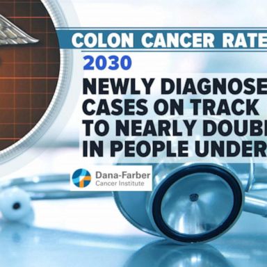 VIDEO: 45 is the new 50 when it comes to screening for colon cancer