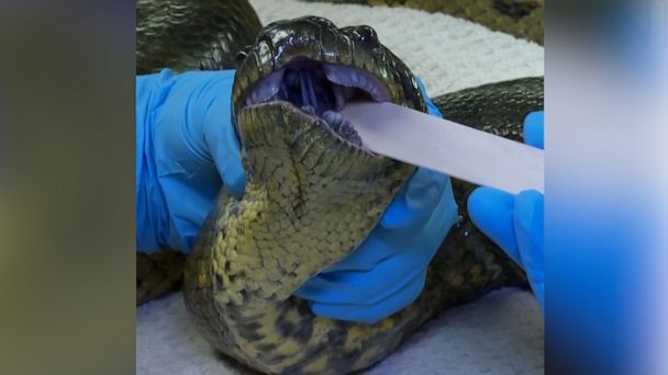 Video How A 13 Foot Long Anaconda Gets Its Check Up At The Veterinarian Abc News 2333