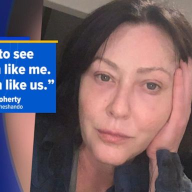 VIDEO: Shannen Doherty calls out Hollywood’s Botox obsession