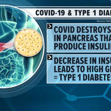 VIDEO: Why some develop type 1 diabetes after suffering severe COVID-19