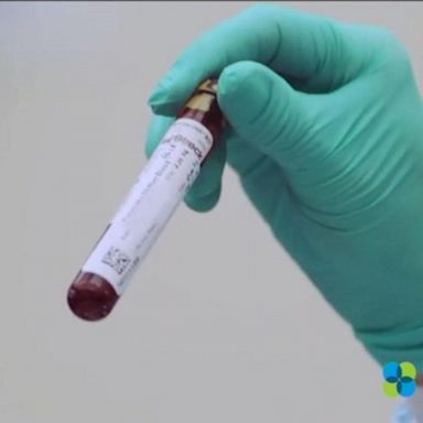 VIDEO: Cutting edge test could detect early cancer recurrence