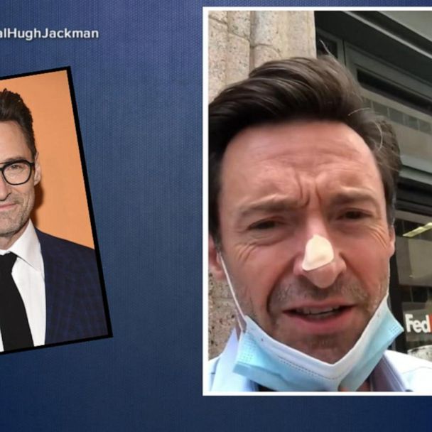 Hugh Jackman Continues His Personal Sunscreen PSA After Another