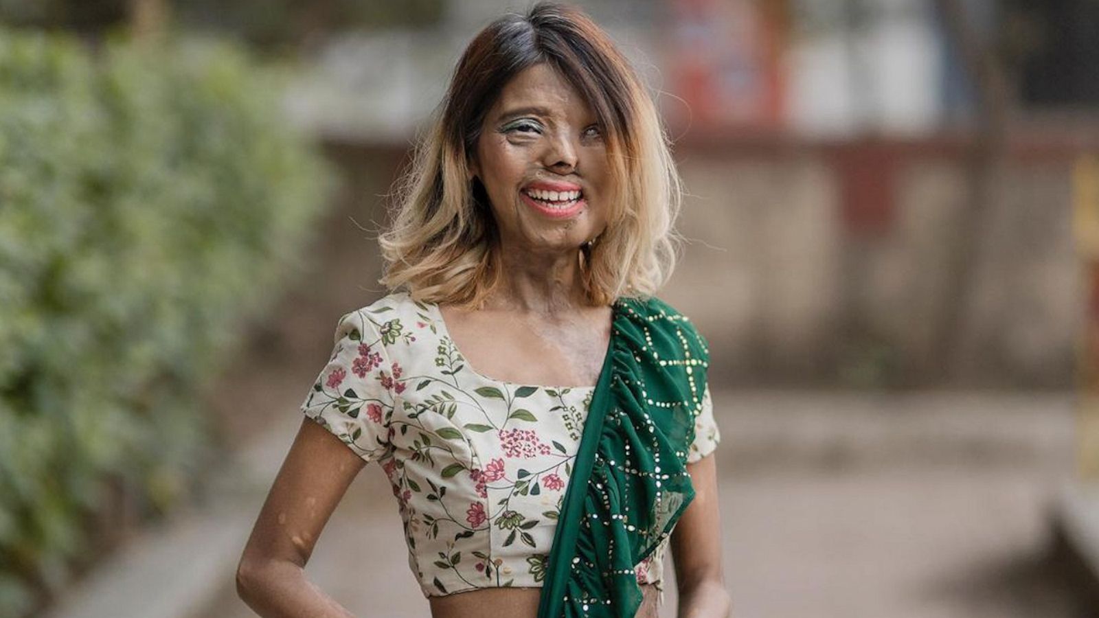 VIDEO: This acid attack survivor is redefining beauty