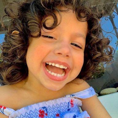 VIDEO: Why one three-year-old with a rare condition has 1.5 million friends on TikTok