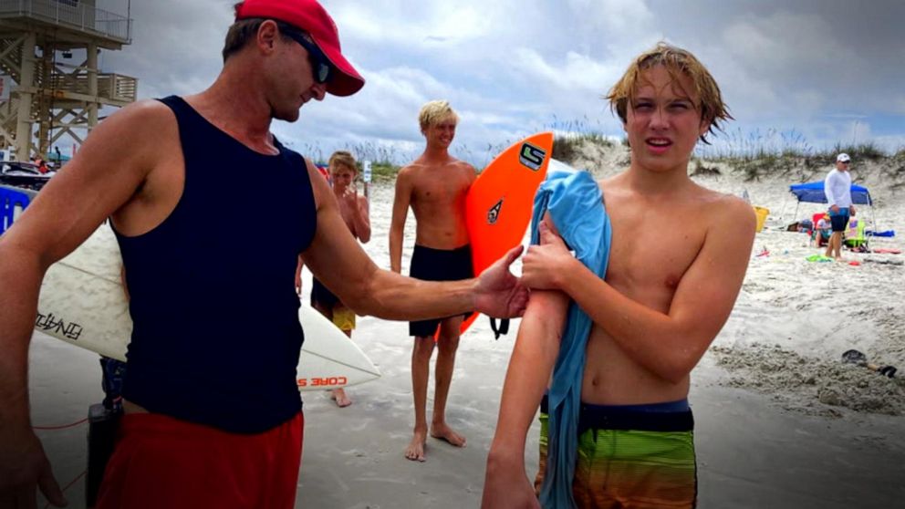 VIDEO: Surfer recalls details of shark encounter caught on camera