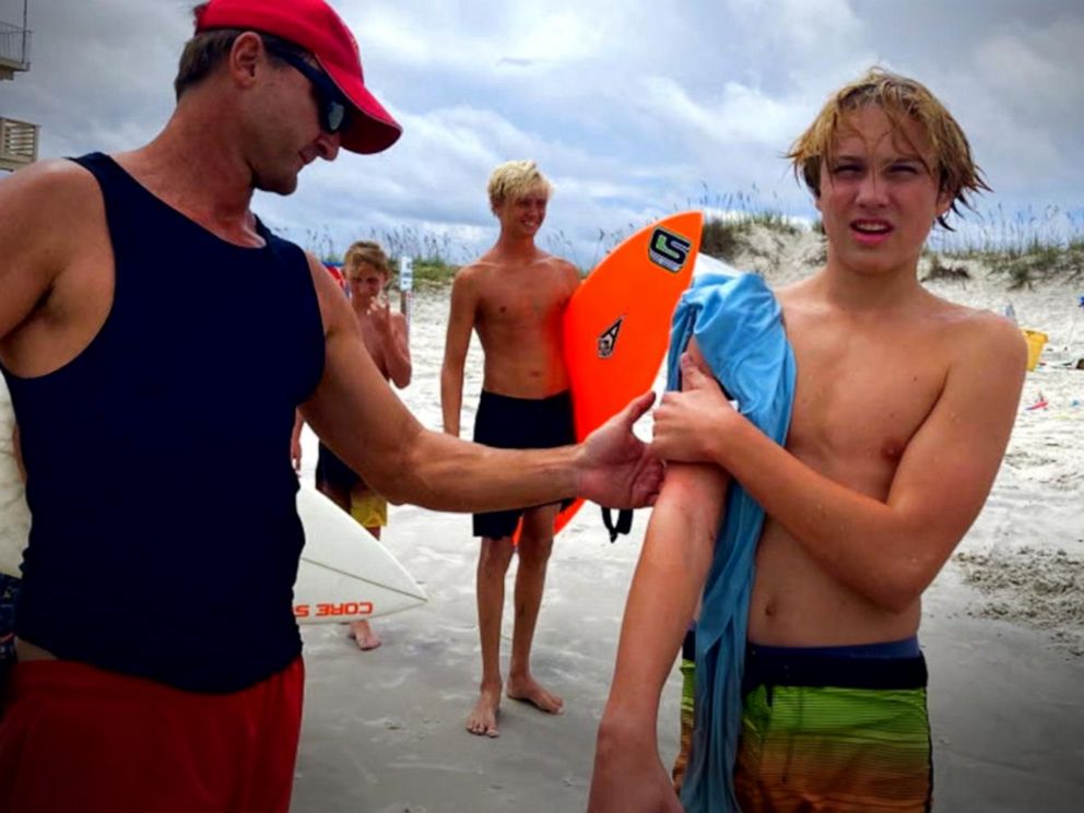 Tybee surf instructor back in the ocean two days after shark bite