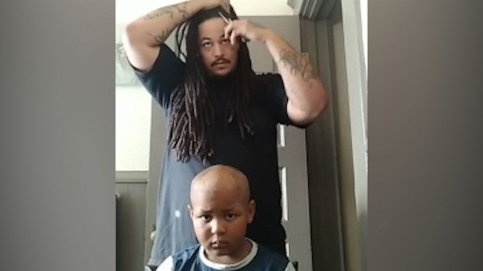 VIDEO: Ohio dad shaves his head in solidarity with son who has a rare form of bone cancer 