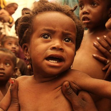 VIDEO: Madagascar on brink of world’s 1st climate change-driven famine