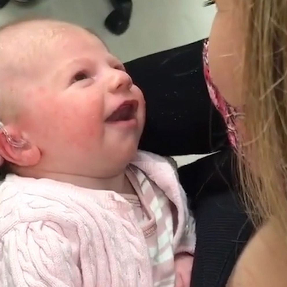 VIDEO: Baby hears mom’s voice for the first time in emotional video 