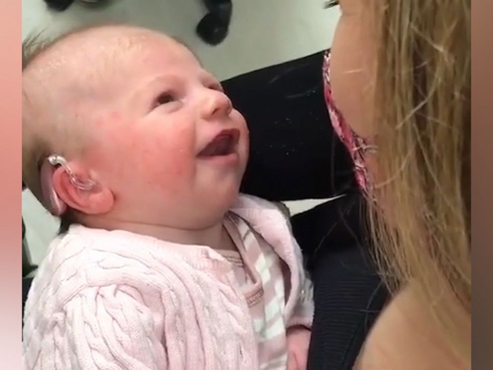 Baby hears mom's voice for the 1st time in emotional video - ABC News