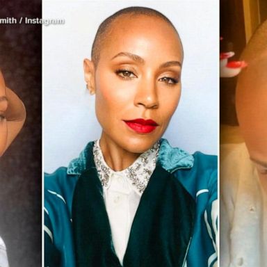 VIDEO: Jada Pinkett Smith opens up about her alopecia and hair loss journey