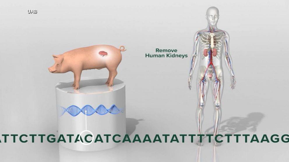 Pig-human transplants may be a misguided attempt to address the