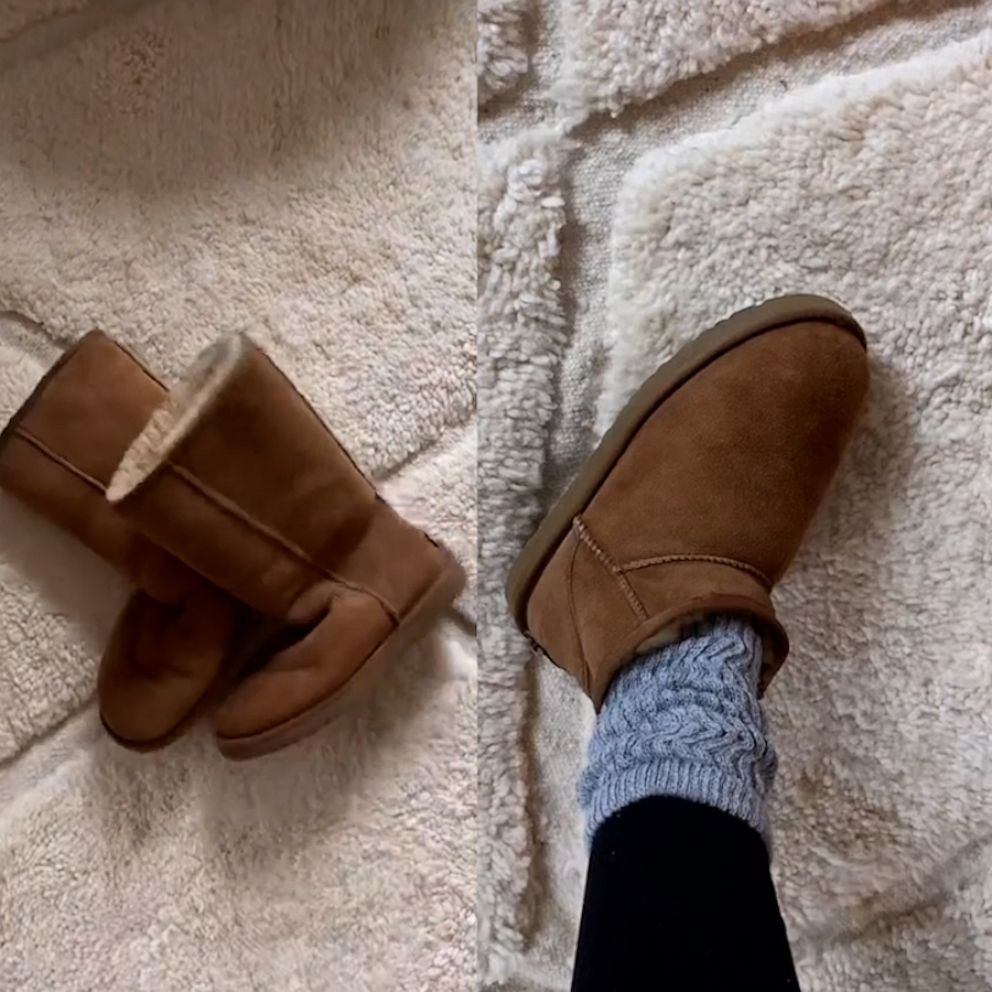 How To Make UGGs Look Cute, How To Wear UGGs To Work