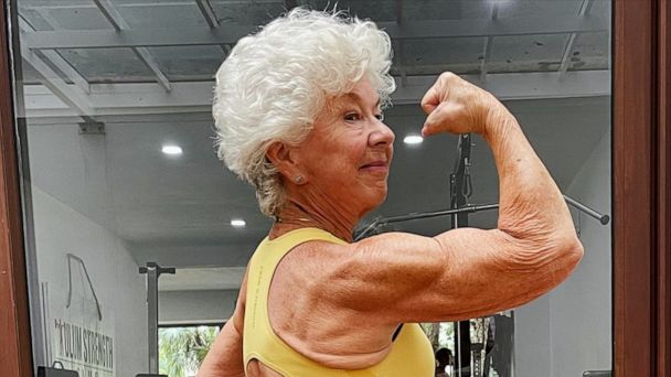 A 71-Year-Old Woman Took up Bodybuilding After Back Surgery