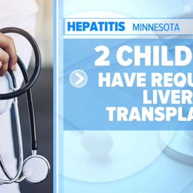 VIDEO: 10 states report increase of severe hepatitis among children