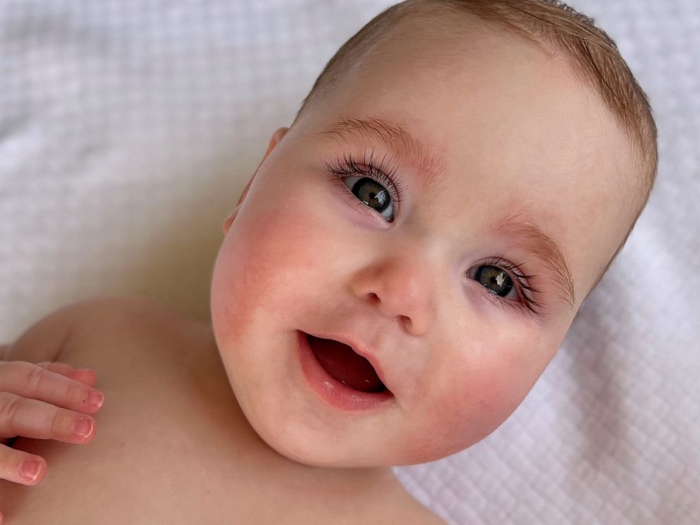 2022 Gerber baby contest winner: Meet Isa Slish, Gerber's newest spokesbaby  shining a light on limb differences - ABC7 Chicago