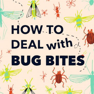 VIDEO: How to deal with bug bites