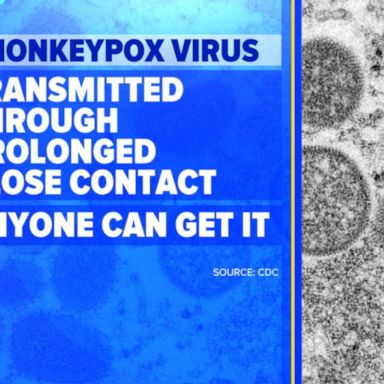 VIDEO: Fears of monkeypox outbreak grow as cases rise