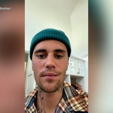 VIDEO: Justin Bieber reveals his face is partially paralyzed