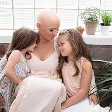 VIDEO: Mom with alopecia opens up about hair loss journey and what she wants her daughters to know