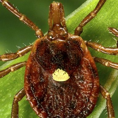 VIDEO: Experts warn of possible meat allergy associated with tick bites