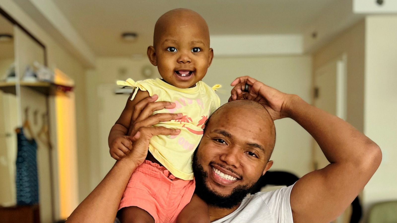 VIDEO: Dad shaves off dreadlocks he grew out for 10 years to support daughter with cancer