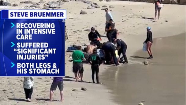 California surfer hospitalized after shark attack