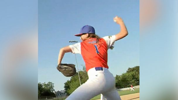 11-year-old born without fingers on one hand is a baseball star