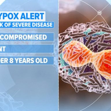 VIDEO: New York declares monkeypox public health emergency