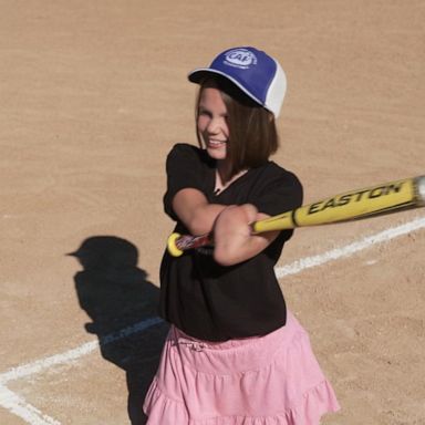 VIDEO: Quadruple limb deficient baseball player pays it forward