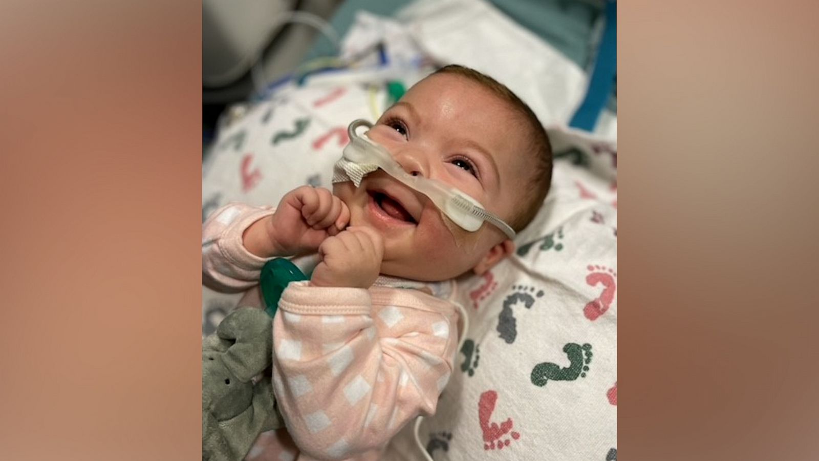 VIDEO: Twin baby with one lung survives against all odds