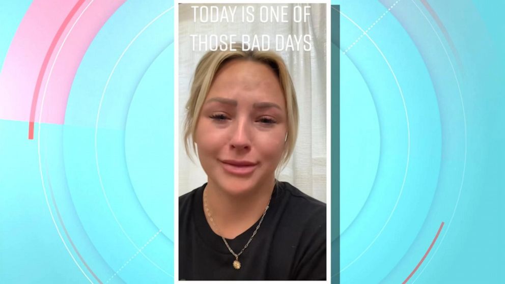 Woman Diagnosed With Breast Cancer At 29 Shares Viral Message On TikTok ...