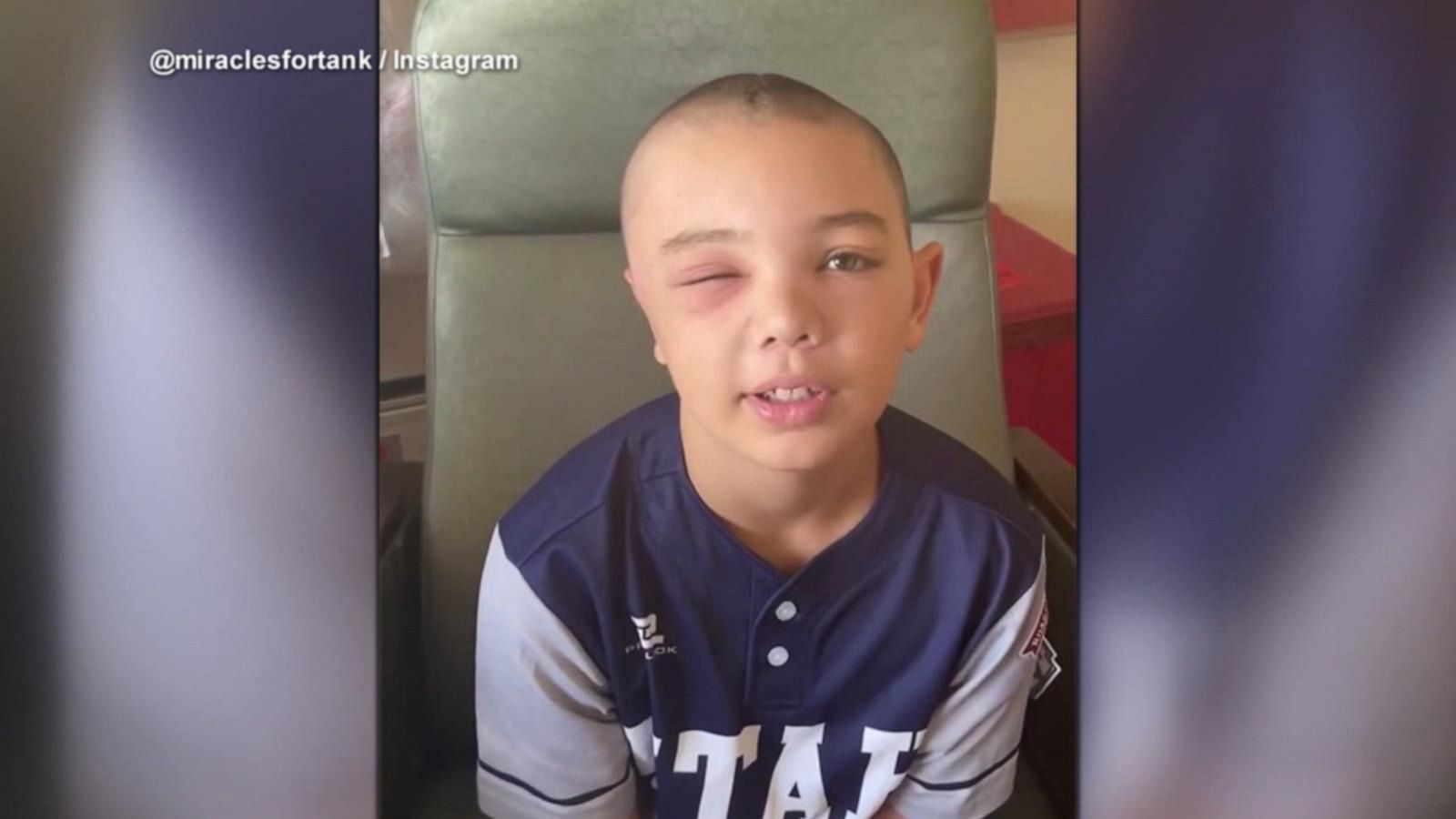 Little League player injured from bunk bed fall speaks out Good