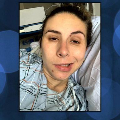 VIDEO: New mom diagnosed with Bell’s palsy shares journey