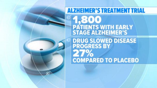 Video Promising New Alzheimer’s Treatment - ABC News