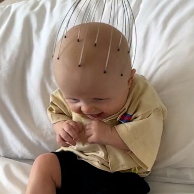 VIDEO: Watch this baby's amazing reaction to a head massager