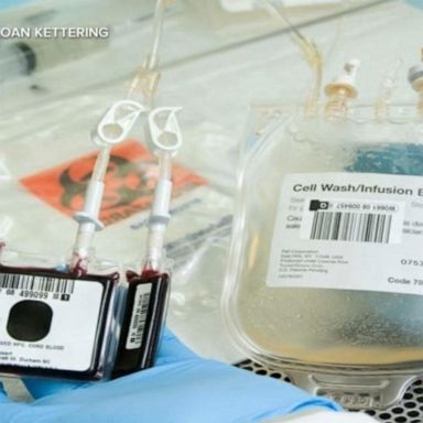 VIDEO: How 'cord blood’ is helping bone marrow transplant research