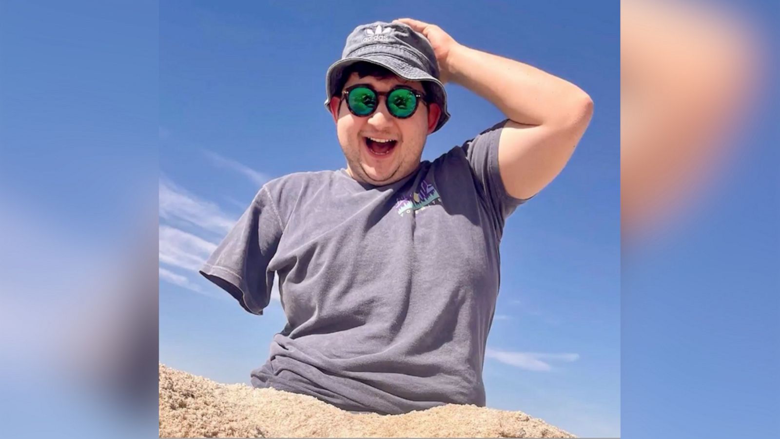 VIDEO: TikToker loves making people laugh and sharing life with one limb