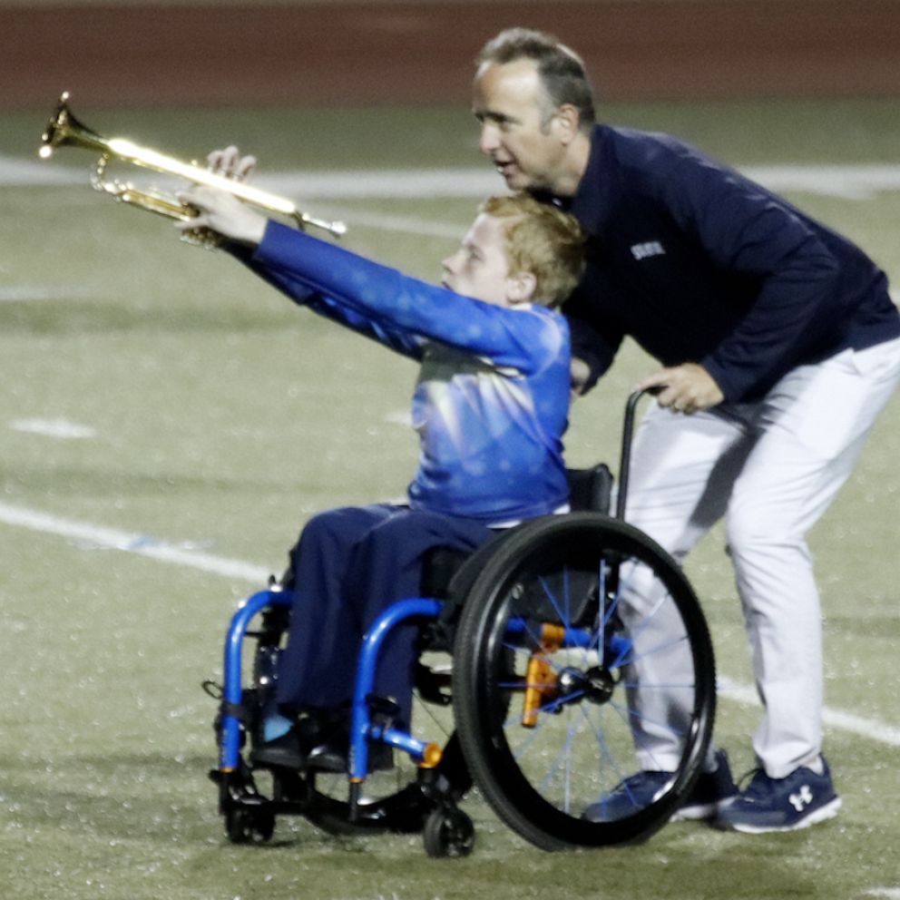 High School Band Director Helps Student Perform With Marching Band 