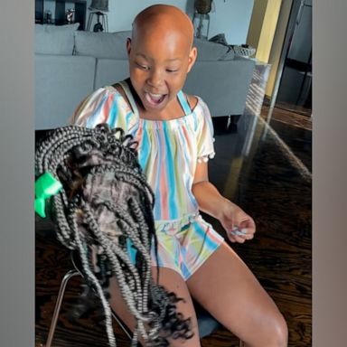 VIDEO: Woman who makes children's wigs helps girl with alopecia